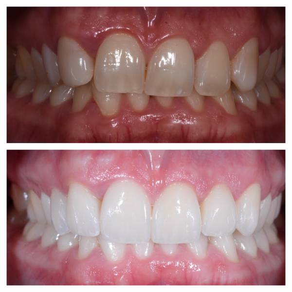 PROFESSIONNEL DE FABRICATION DE PROTHESES DENTAIRES POUR DENTISTES NICE